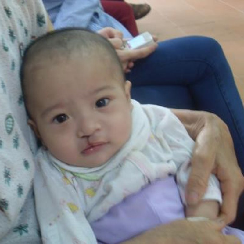 Chương Trình Phẫu Thuật Nụ Cười Tháng 8/2016